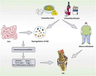 The effects and significance of gut microbiota and its metabolites on the regulation of osteoarthritis: Close coordination of gut-bone axis